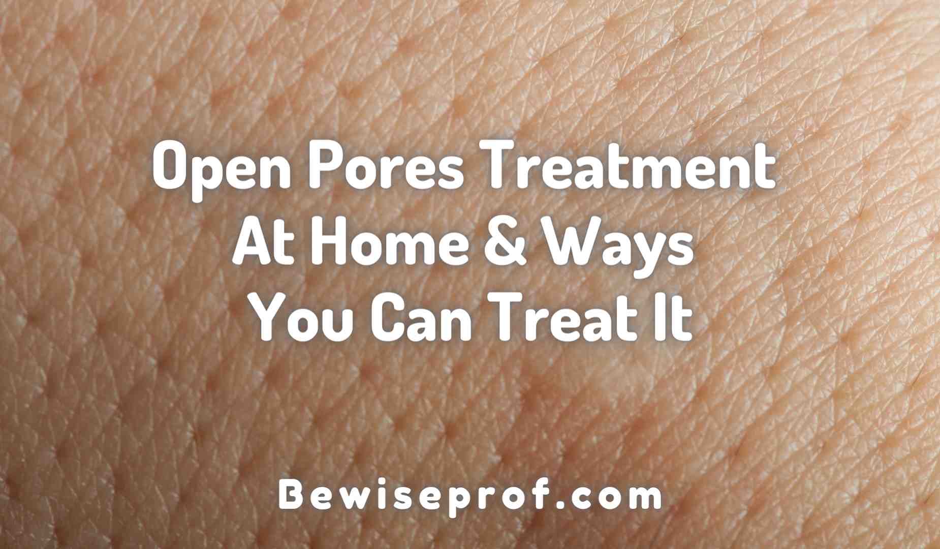 Open Pores Treatment At Home And Ways You Can Treat It