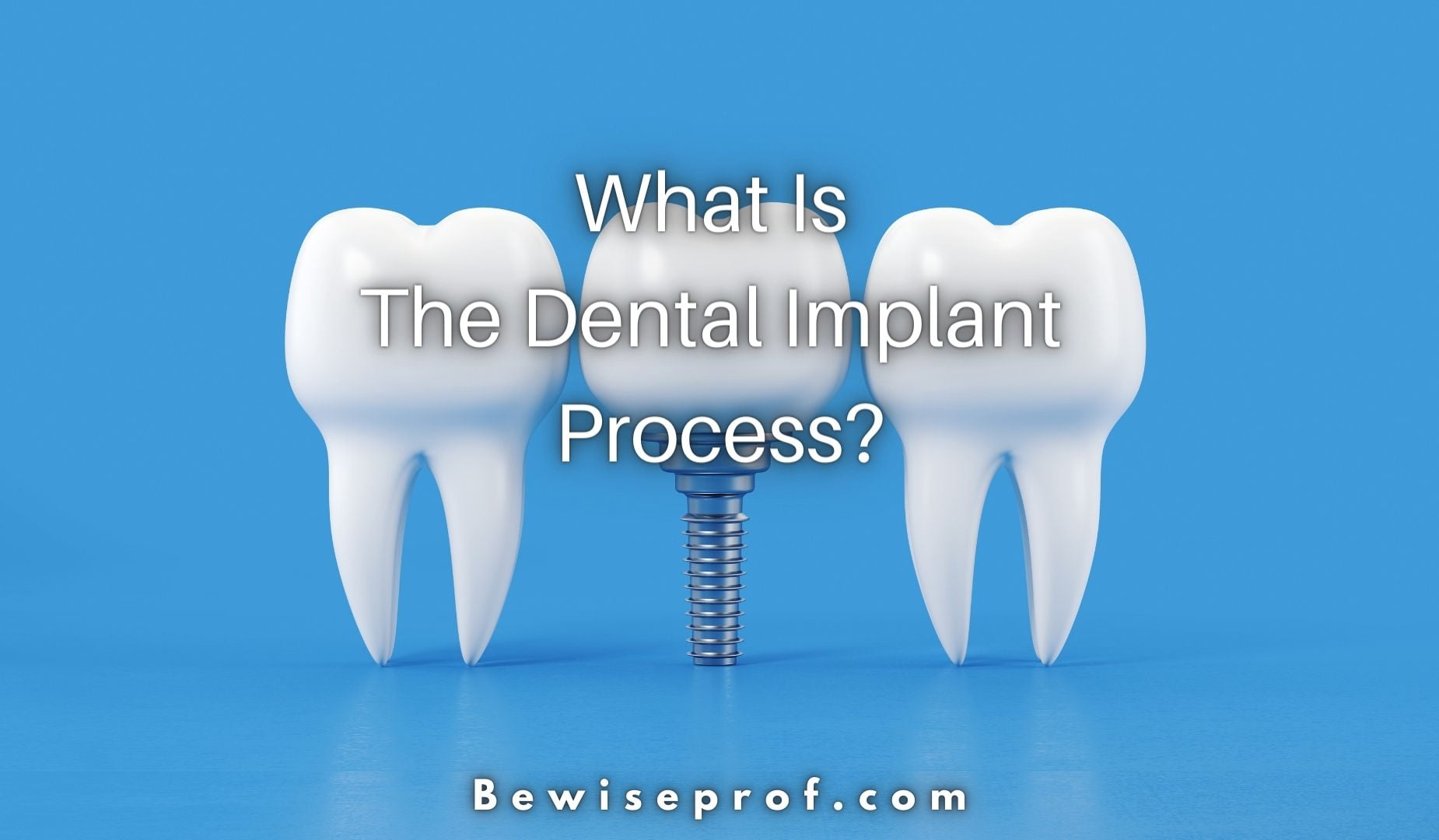 What Is The Dental Implant Approach?