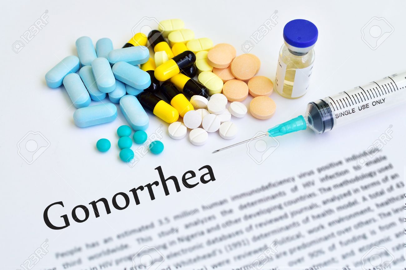 All you want to Know about Gonorrhea therapy Element 1