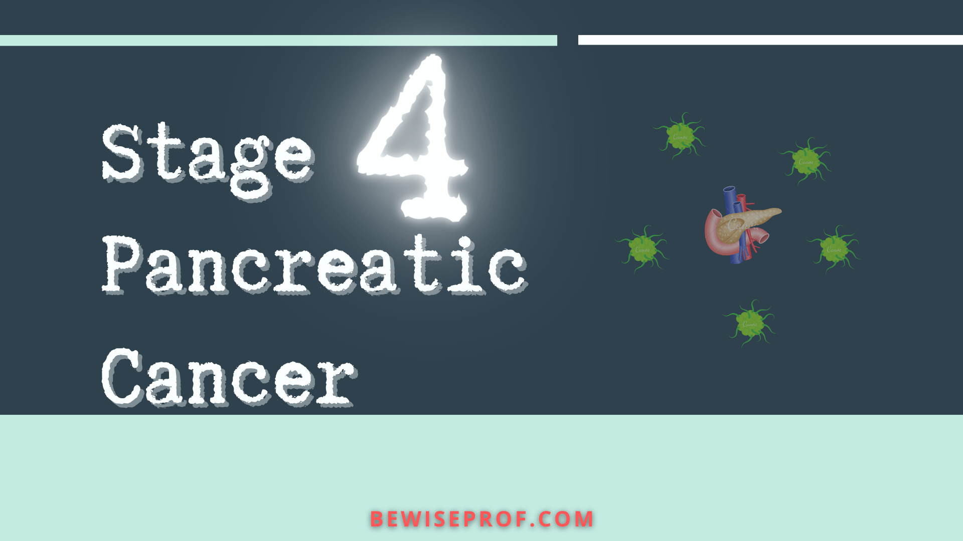 Phase 4 Pancreatic Cancer – Be Smart Professor