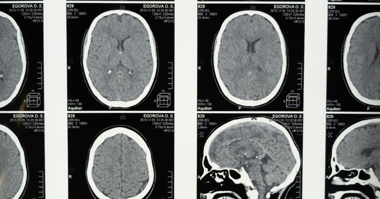 The Revolution In and Evolution of TMS Technological know-how