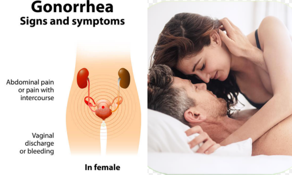 All you have to have to know about gonorrhea treatment Portion 2