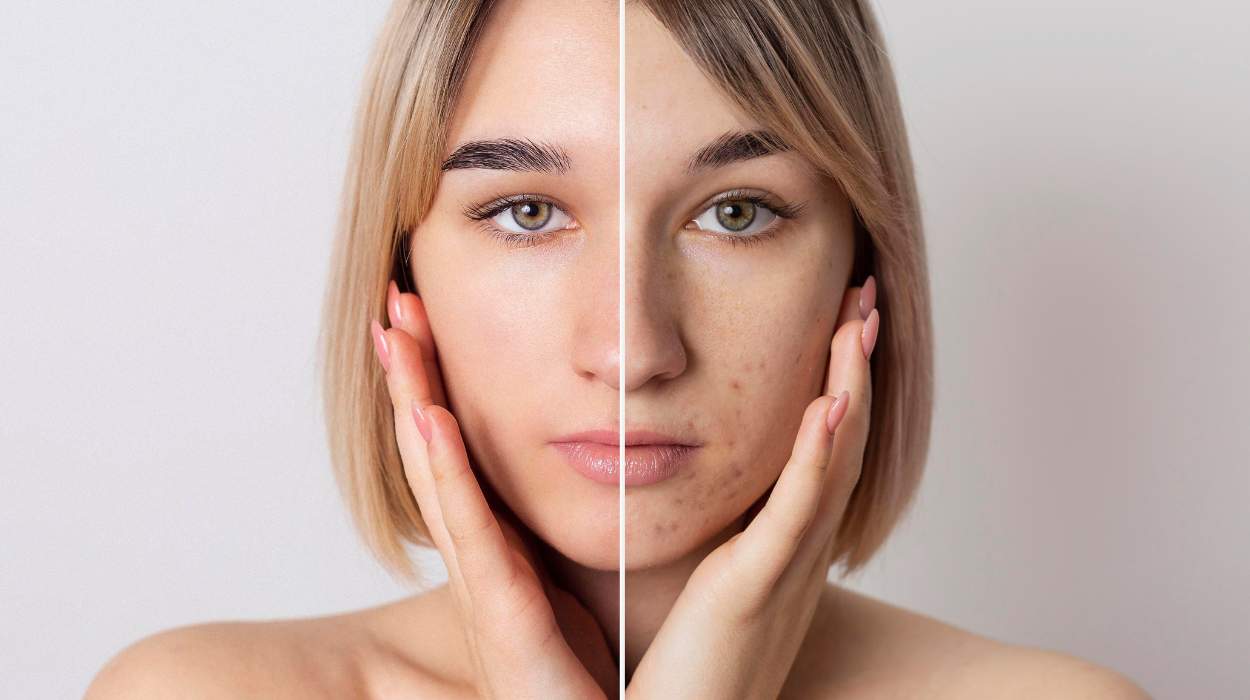 Best Dark Spot Remover For Face